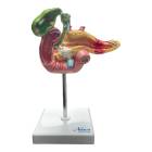 Nasco MG30031 Pancreas, Duodenum, and Gallbladder with Pathologies Model - Front View