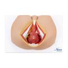 Nasco MG30415 Male Perineum Model