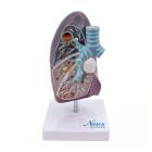 Nasco MG30885 Lung Pathology Model, 1.5x Enlarged