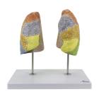 Nasco MG30886 Segmented Lung Model, Front View