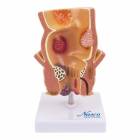 Nasco MG31005 Hemorrhoids Model, 5x Enlarged - Front View