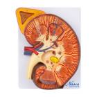 Nasco MG31103 Kidney Section with Adrenal Gland Model, 3x Enlarged