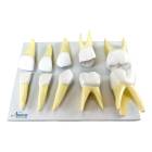 Nasco MG31150 Baby Teeth Model, 10x Enlarged