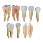 Nasco MG31151 Teeth Models, 10x Enlarged, 5 Parts - Set