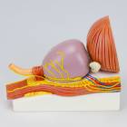 Nasco MG34924 Prostate with Pathology Model - Side View