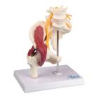 Nasco MG35509 Hip with Muscles and Sciatic Nerve Model - Front View