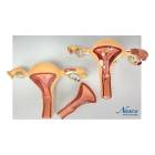 Nasco MG35528 Healthy and Pathological Uterus Models - Top View