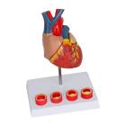 Nasco MG35530 Heart with Arteriosclerosis Model