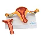 Nasco MG36026 Uterus with Ovary Model, 2 Parts - Front View