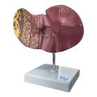 Nasco MG36148 Liver Section with Pathology Model - Front View