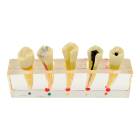 Nasco MG39443 Endodontics Dental Model, 5 Parts - Front View