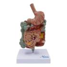 Nasco MG39708 Gastrointestinal Tract with Pathologies Model