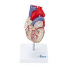 Nasco MG7330 Transparent Heart with Conductive System Model