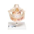 Adult Denture Model
