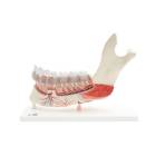 3B Scientific VE290 Advanced Half Lower Jaw with 8 Diseased Teeth 19-Part - 3B Smart Anatomy