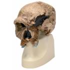 Anthropological Skull Model - Steinheim