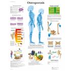 Osteoporosis Chart