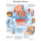 Rheumatic Diseases Chart