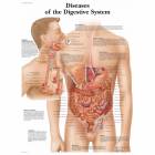 Diseases Digestive System Chart