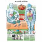 Diabetesmellitus Chart