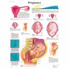 3B Scientific VR1556L Glossy Laminated Paper Female Breast Anatomy,  Pathology and Self-Examination Chart, Poster Size 20 Width x 26 Height