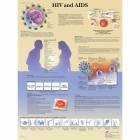 HIV and AIDS Chart