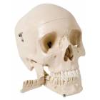 Skull Model with Teeth for Extraction - 4 Part