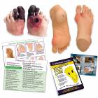 Life/form Complete Diabetic Foot Care Education